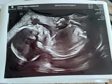 Ultrasound photograph shared by Ben and Leonieke Salmons in their September 2026 pregnancy update.